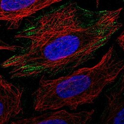 PGM1 Antibody, Novus Biologicals 0.1mL; Unlabeled:Antibodies, Polyclonal